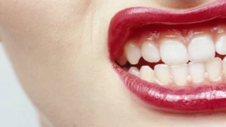 Şehir hayatı diş gıcırdartmanın en önemli nedeni